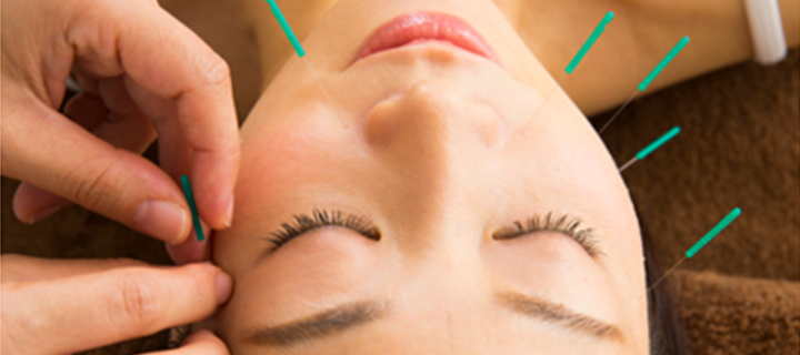 ここぞという時に人気の鍼