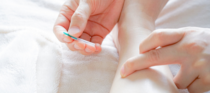 5.経穴（ツボ）に鍼をする